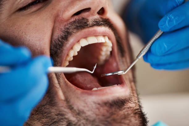 Best Dental Inlays and Onlays  in Lucedale, MS
